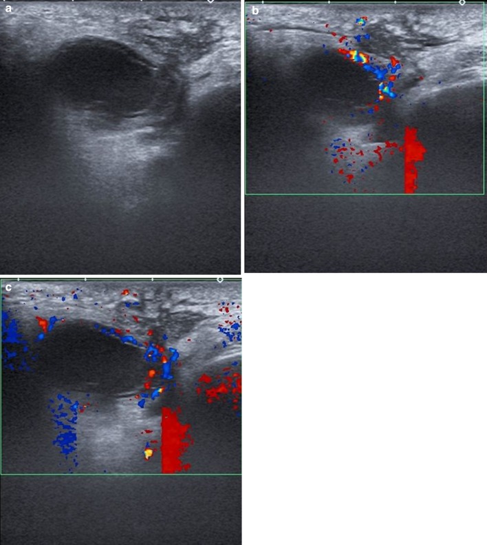 Fig. 3