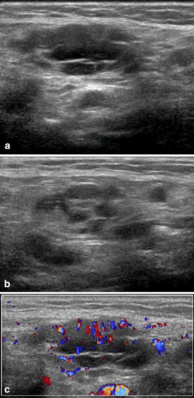 Fig. 2