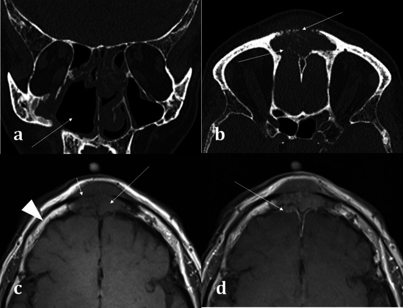 Fig. 6