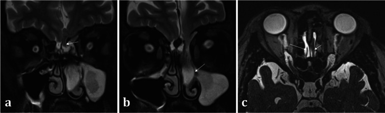 Fig. 16