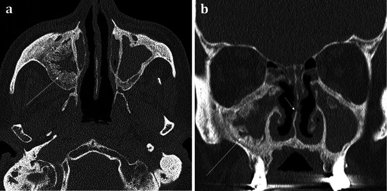 Fig. 9