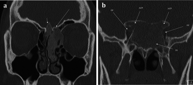 Fig. 17