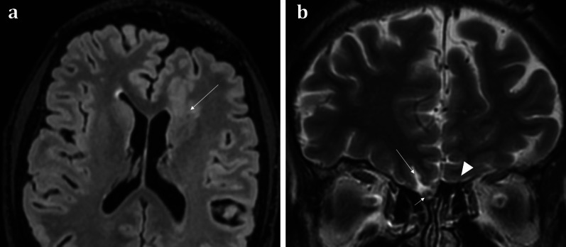 Fig. 11