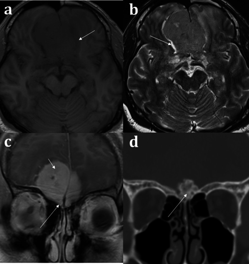 Fig. 13