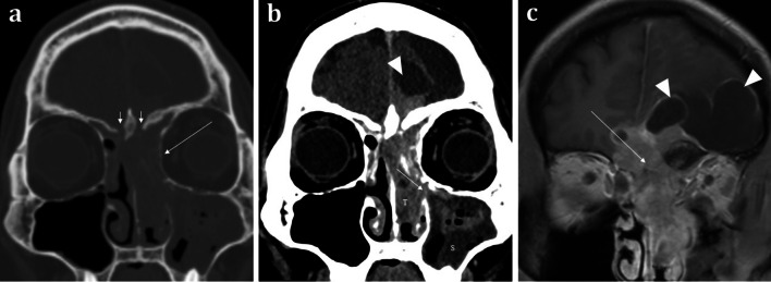 Fig. 12