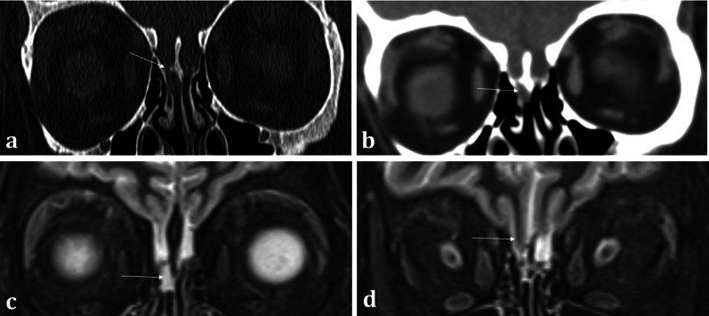 Fig. 15