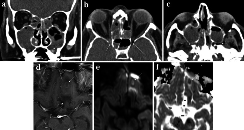 Fig. 8