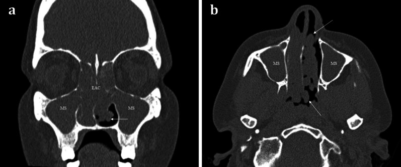 Fig. 7