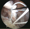 Fig 5