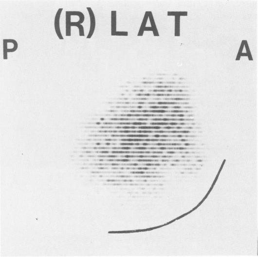 Fig. 9.