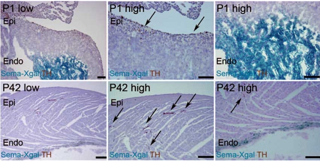 Fig. (3). Inverse expression pattern of Sema3a and sympathetic innervation in mouse hearts.