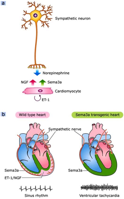 Fig. (5). Cardiac innervation patterning and lethal arrhythmias.