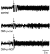 Fig. (1). NGF gene transfer restores impaired sensory innervation in diabetic hearts.