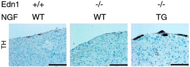 Fig. (2). Cardiac-specific overexpression of NGF overcomes the defects of cardiac sympathetic nervous system in Edn1-/- mice.