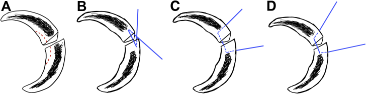 Fig 2