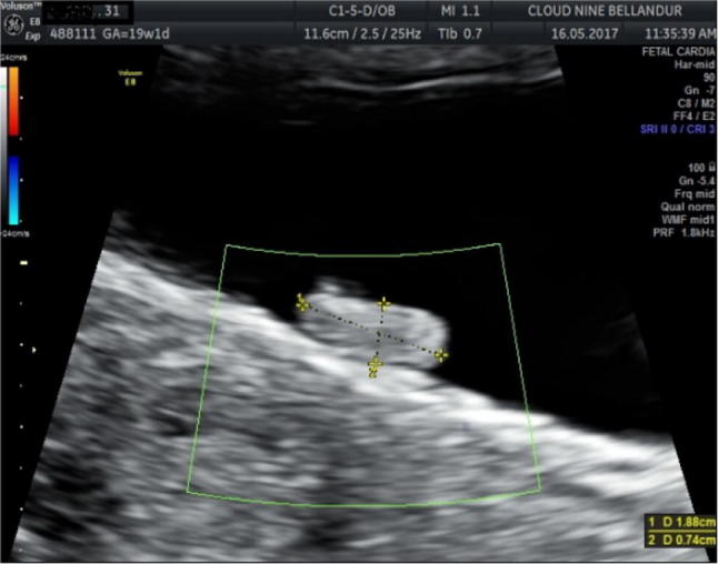 Fig. 1