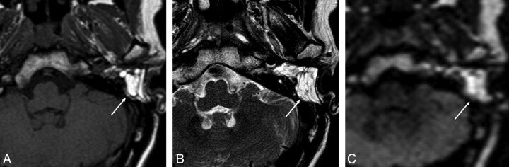 Fig 5.