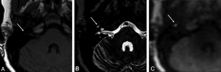 Fig 4.