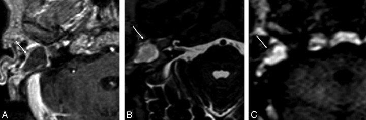 Fig 3.