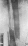 124-1