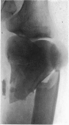 118-1