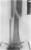124-2