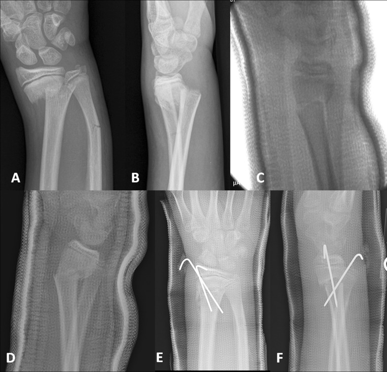 Fig. 1