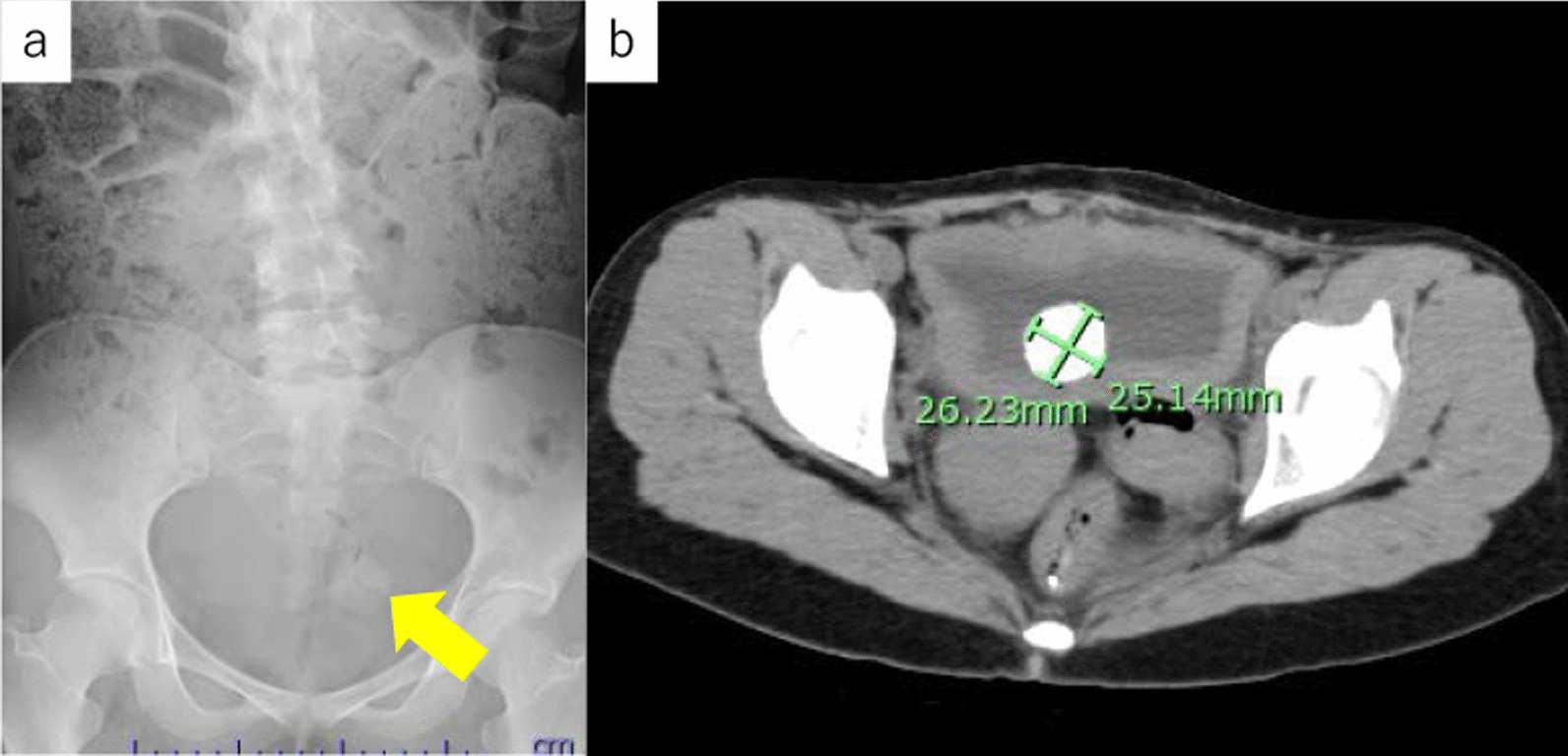 Fig. 1