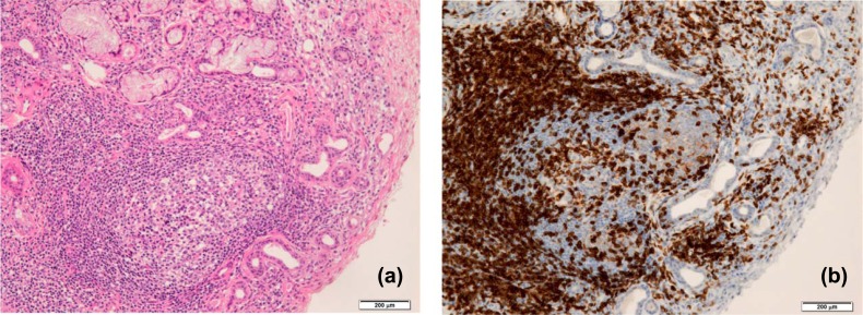 Fig. (2)