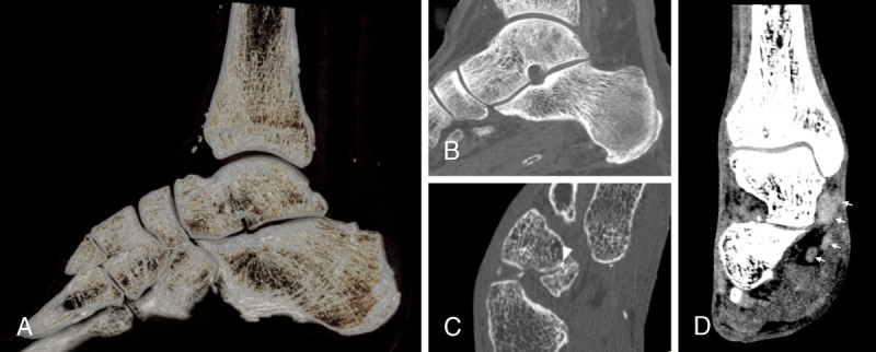 FIGURE 11