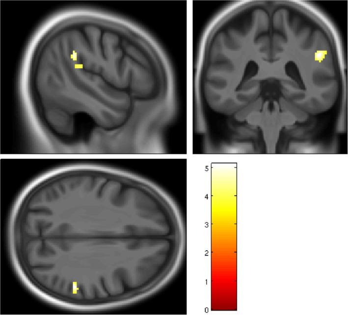 FIGURE 2