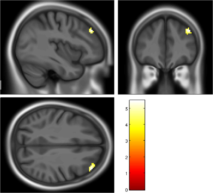 FIGURE 1