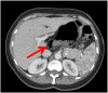Fig. 2