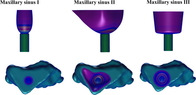Fig. 11