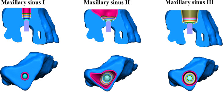 Fig. 9