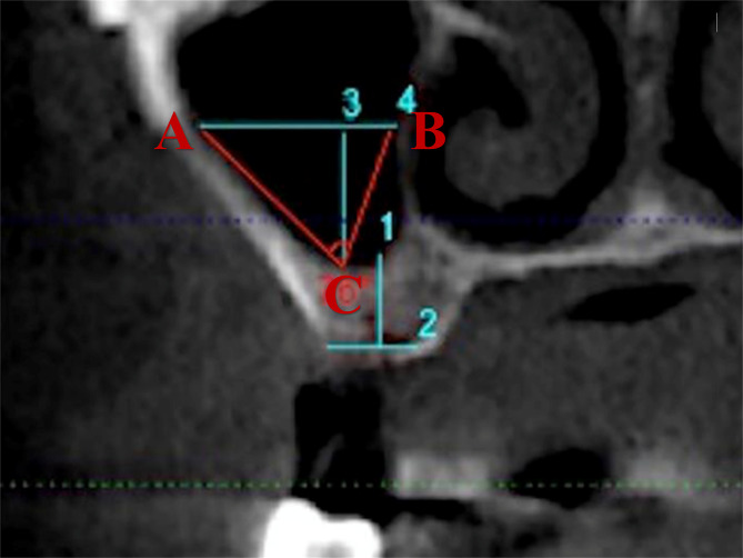 Fig. 2