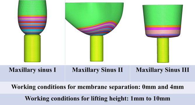 Fig. 13