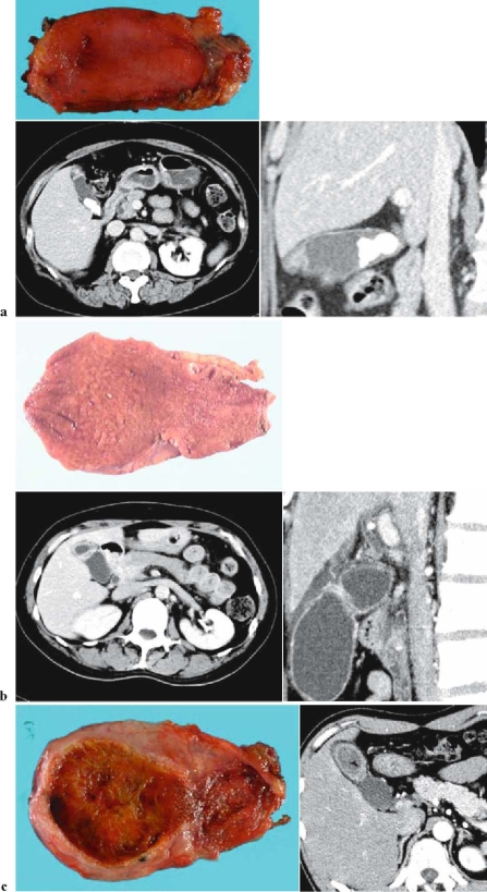 Fig. 3a–c