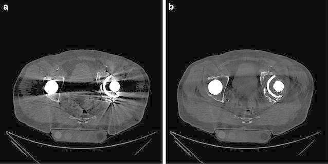 Fig. 6