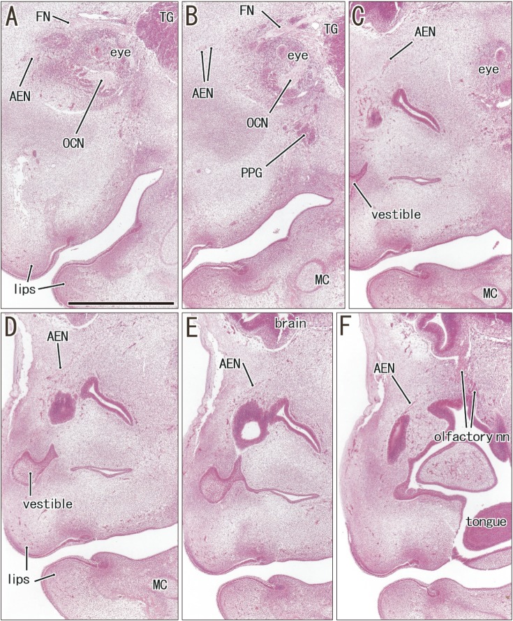 Fig. 3