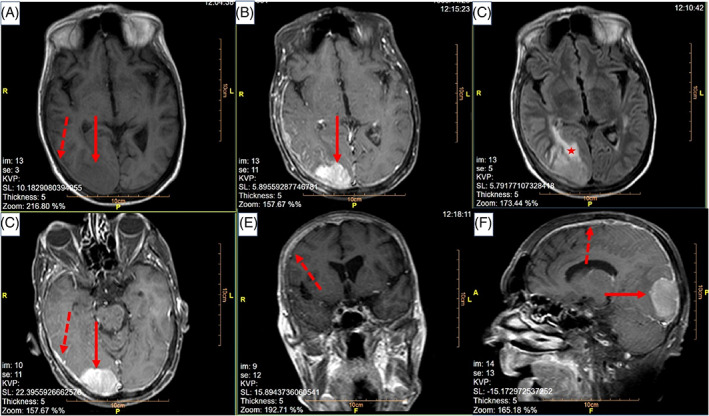 FIGURE 1