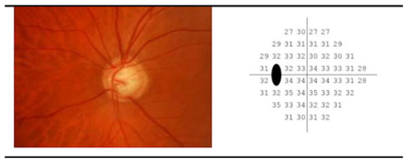 Fig. 1