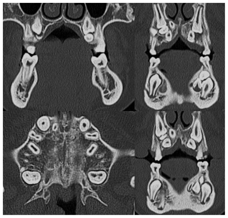 Figure 14