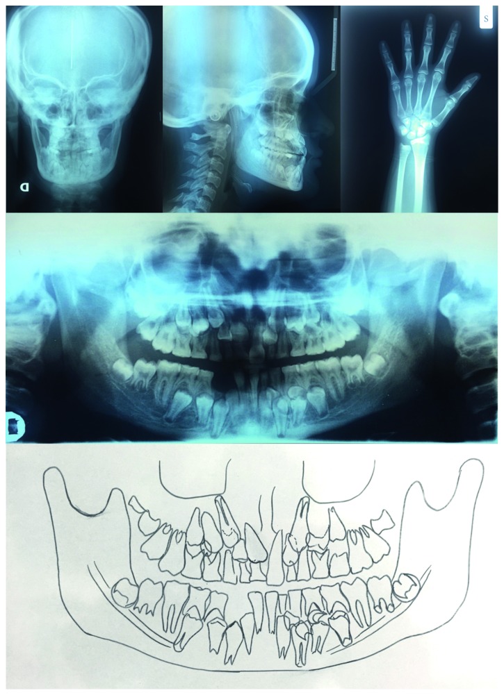 Figure 12