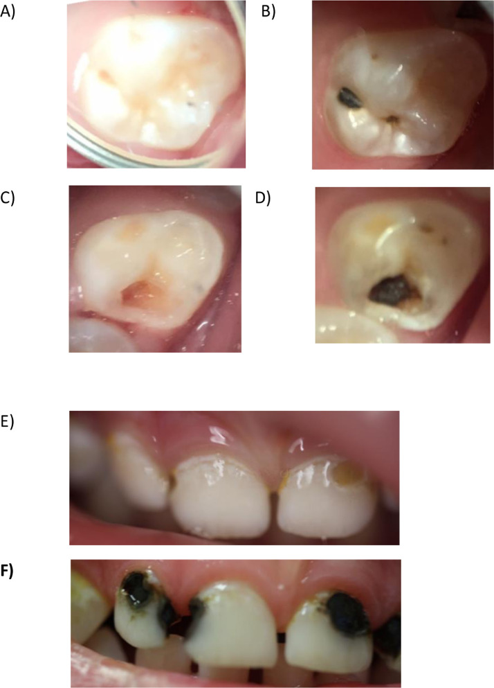 Fig 2