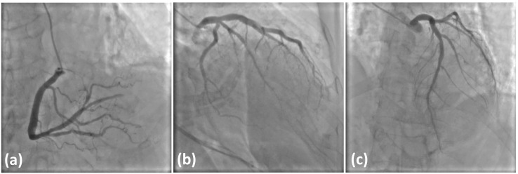 Fig. 2