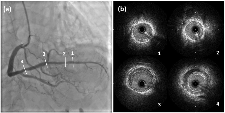 Fig. 4