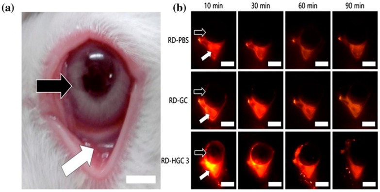 Figure 15