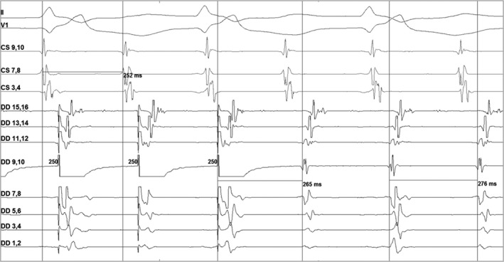 FIGURE 1