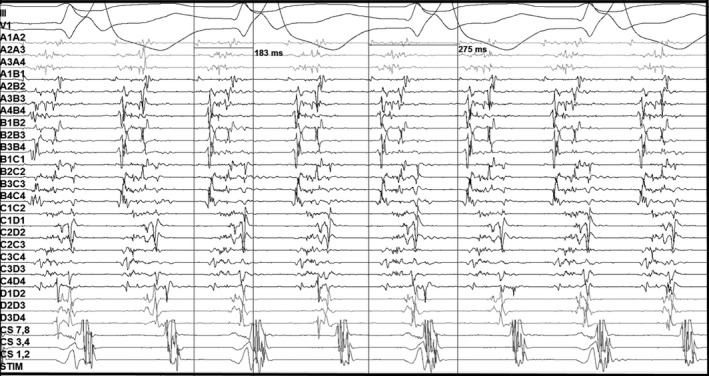 FIGURE 2